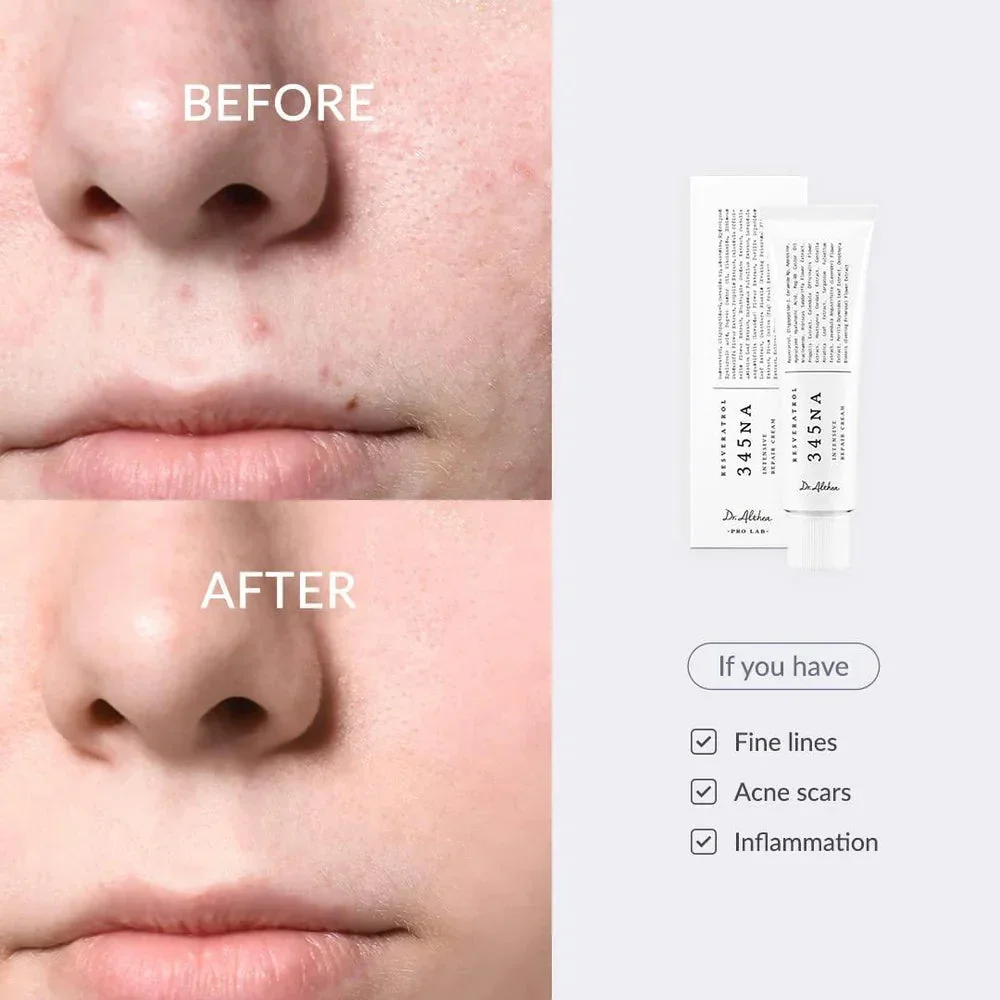 Relief Cream 345, 2-rasm
