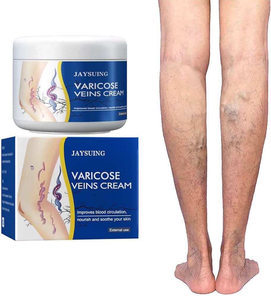 Varicose crem