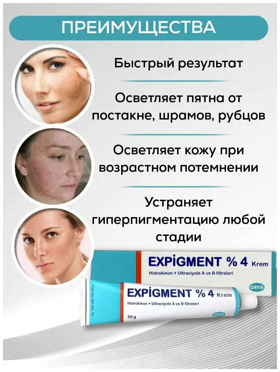 Expigment krem